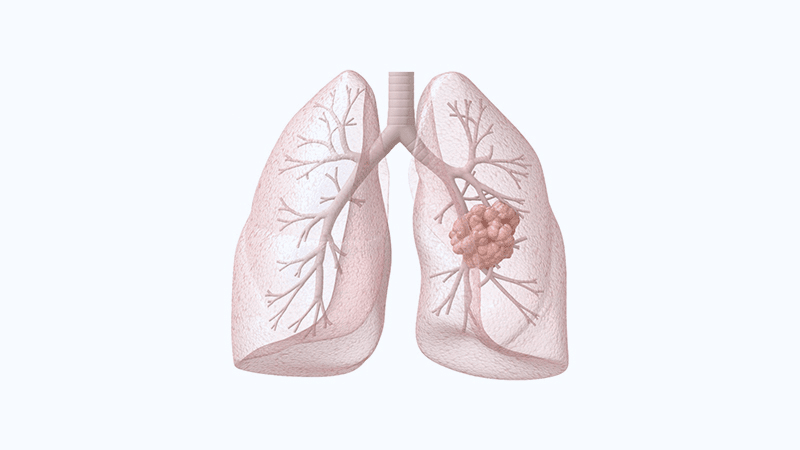 pulmão anatômico com transparência.